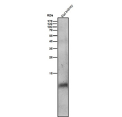 Rat kidney tissue lysate tested with the Phospho-Phospholamban (S16) antibody at 1:2000 dilution for 1 hour at room temperature. A specific band is detected near ~10 kDa, consistent with the phosphorylated form of monomeric Phospholamban. The apparent size exceeds its 6 kDa theoretical mass due to its hydrophobic, multimeric nature and phosphorylation-dependent gel mobility.