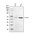 Western blot analysis of KDM8 using anti-KDM8 antibody. Lane 1: human 293T whole cell lysates, Lane 2: human Hela whole cell lysates. After electrophoresis, proteins were transferred to a nitrocellulose membrane at 150 mA for 50-90 minutes. Blocked the membrane with 5% non-fat milk/TBS for 1.5 hour at RT. The membrane was incubated with rabbit anti-KDM8 antibody at 0.5 ug/ml overnight at 4oC, then washed with TBS-0.1%Tween 3 times with 5 minutes each and probed with a goat anti-rabbit IgG-HRP secondary antibody at a dilution of 1:5000 for 1.5 hour at RT. The signal was developed using enhanced chemiluminescent. A predominant band is detected at ~60 kDa in HeLa, consistent with full-length KDM8 migrating above its predicted ~47 kDa due to anomalous mobility and post-translational modification.