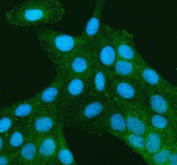 Immunofluorescent staining of TNS3 using anti-TNS3 antibody. TNS3 was detected in an immunocytochemical section of U2OS cells. Enzyme antigen retrieval was performed using IHC enzyme antigen retrieval reagent for 15 mins. The cells were blocked with 10% goat serum. And then incubated with 5 ug/ml rabbit anti-TNS3 antibody overnight at 4oC. DyLight 488 Conjugated Goat Anti-Rabbit IgG was used as secondary antibody at 1:500 dilution and incubated for 30 minutes at 37oC. The section was counterstained with DAPI nuclear stain (blue). TNS3 localizes to focal adhesions as peripheral puncta and short streaks at stress-fiber termini, consistent with its focal-adhesion scaffold role.