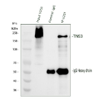 Immunoprecipitating TNS3 in U251 whole cell lysate. Western blot analysis of TNS3 using anti-TNS3 antibody. Lane 1: U251 whole cell lysates (30ug), Lane 2: Rabbit control IgG instead of anti-TNS3 antibody in U251 whole cell lysate, Lane 3: anti-TNS3 antibody (2ug) + U251 whole cell lysate (500ug). After electrophoresis, proteins were transferred to a membrane. Then the membrane was incubated with rabbit anti-TNS3 antibody at a dilution of 0.5 ug/ml and probed with a mouse anti-rabbit IgG-HRP secondary antibody. The signal is developed using ECL Plus Western Blotting Substrate. The expected molecular weight of TNS3 is at 155-170 kDa.