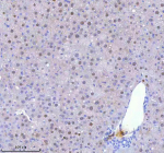 Immunohistochemical staining of BCCIP using anti-BCCIP antibody. BCCIP was detected in a paraffin-embedded section of mouse liver tissue. Heat mediated antigen retrieval was performed in EDTA buffer (pH 8.0, epitope retrieval solution). The tissue section was blocked with 10% goat serum. The tissue section was then incubated with 2 ug/ml rabbit anti-BCCIP antibody overnight at 4oC. Peroxidase Conjugated Goat Anti-rabbit IgG was used as secondary antibody and incubated for 30 minutes at 37oC. The tissue section was developed using an HRP secondary and DAB substrate.