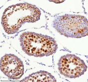 Immunohistochemical staining of BCCIP using anti-BCCIP antibody. BCCIP was detected in a paraffin-embedded section of rat testis tissue. Heat mediated antigen retrieval was performed in EDTA buffer (pH 8.0, epitope retrieval solution). The tissue section was blocked with 10% goat serum. The tissue section was then incubated with 2 ug/ml rabbit anti-BCCIP antibody overnight at 4oC. Peroxidase Conjugated Goat Anti-rabbit IgG was used as secondary antibody and incubated for 30 minutes at 37oC. The tissue section was developed using an HRP secondary and DAB substrate.