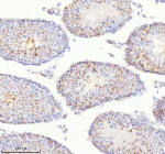 Immunohistochemical staining of BCCIP using anti-BCCIP antibody. BCCIP was detected in a paraffin-embedded section of mouse testis tissue. Heat mediated antigen retrieval was performed in EDTA buffer (pH 8.0, epitope retrieval solution). The tissue section was blocked with 10% goat serum. The tissue section was then incubated with 2 ug/ml rabbit anti-BCCIP antibody overnight at 4oC. Peroxidase Conjugated Goat Anti-rabbit IgG was used as secondary antibody and incubated for 30 minutes at 37oC. The tissue section was developed using an HRP secondary and DAB substrate.