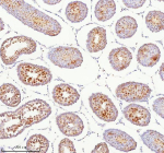 Immunohistochemical staining of BCCIP using anti-BCCIP antibody. BCCIP was detected in a paraffin-embedded section of rat testis tissue. Heat mediated antigen retrieval was performed in EDTA buffer (pH 8.0, epitope retrieval solution). The tissue section was blocked with 10% goat serum. The tissue section was then incubated with 2 ug/ml rabbit anti-BCCIP antibody overnight at 4oC. Peroxidase Conjugated Goat Anti-rabbit IgG was used as secondary antibody and incubated for 30 minutes at 37oC. The tissue section was developed using an HRP secondary and DAB substrate.
