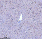 Immunohistochemical staining of BCCIP using anti-BCCIP antibody. BCCIP was detected in a paraffin-embedded section of mouse liver tissue. Heat mediated antigen retrieval was performed in EDTA buffer (pH 8.0, epitope retrieval solution). The tissue section was blocked with 10% goat serum. The tissue section was then incubated with 2 ug/ml rabbit anti-BCCIP antibody overnight at 4oC. Peroxidase Conjugated Goat Anti-rabbit IgG was used as secondary antibody and incubated for 30 minutes at 37oC. The tissue section was developed using an HRP secondary and DAB substrate.