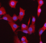 Immunofluorescent staining of BCCIP using anti-BCCIP antibody. BCCIP was detected in an immunocytochemical section of cells. Enzyme antigen retrieval was performed using IHC enzyme antigen retrieval reagent for 15 mins. The cells were blocked with 10% goat serum. And then incubated with 5 ug/ml rabbit anti-BCCIP antibody overnight at 4oC. Cy3 Conjugated Goat Anti-Rabbit IgG was used as secondary antibody at 1:500 dilution and incubated for 30 minutes at 37oC. The section was counterstained with DAPI nuclear stain (blue). Visualize using a fluorescence microscope and filter sets appropriate for the label used.