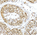 Immunohistochemical staining of BCCIP using anti-BCCIP antibody. BCCIP was detected in a paraffin-embedded section of human testis tissue. Heat mediated antigen retrieval was performed in EDTA buffer (pH 8.0, epitope retrieval solution). The tissue section was blocked with 10% goat serum. The tissue section was then incubated with 2 ug/ml rabbit anti-BCCIP antibody overnight at 4oC. Peroxidase Conjugated Goat Anti-rabbit IgG was used as secondary antibody and incubated for 30 minutes at 37oC. The tissue section was developed using an HRP secondary and DAB substrate.