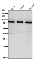 All lanes use the Pan-PKC antibody at 1:2K dilution for 1 hour at room temperature.