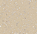 Immunohistochemical staining of SNCA using anti-SNCA antibody. SNCA was detected in a paraffin-embedded section of human brain tissue. Heat mediated antigen retrieval was performed in EDTA buffer (pH 8.0, epitope retrieval solution). The tissue section was blocked with 10% goat serum. The tissue section was then incubated with 2 ug/ml rabbit anti-SNCA antibody overnight at 4oC. Peroxidase Conjugated Goat Anti-rabbit IgG was used as secondary antibody and incubated for 30 minutes at 37oC. The tissue section was developed using an HRP secondary and DAB substrate.