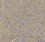 Immunohistochemical staining of SNCA using anti-SNCA antibody. SNCA was detected in a paraffin-embedded section of rat brain tissue. Heat mediated antigen retrieval was performed in EDTA buffer (pH 8.0, epitope retrieval solution). The tissue section was blocked with 10% goat serum. The tissue section was then incubated with 2 ug/ml rabbit anti-SNCA antibody overnight at 4oC. Peroxidase Conjugated Goat Anti-rabbit IgG was used as secondary antibody and incubated for 30 minutes at 37oC. The tissue section was developed using an HRP secondary and DAB substrate.