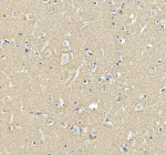 Immunohistochemical staining of SNCA using anti-SNCA antibody. SNCA was detected in a paraffin-embedded section of human brain tissue. Heat mediated antigen retrieval was performed in EDTA buffer (pH 8.0, epitope retrieval solution). The tissue section was blocked with 10% goat serum. The tissue section was then incubated with 2 ug/ml rabbit anti-SNCA antibody overnight at 4oC. Peroxidase Conjugated Goat Anti-rabbit IgG was used as secondary antibody and incubated for 30 minutes at 37oC. The tissue section was developed using an HRP secondary and DAB substrate.