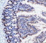 Immunohistochemical staining of Neurokinin 1 Receptor using anti-NKR1 antibody. Neurokinin 1 Receptor was detected in a paraffin-embedded section of rat colon tissue. Heat mediated antigen retrieval was performed in EDTA buffer (pH 8.0, epitope retrieval solution). The tissue section was blocked with 10% goat serum. The tissue section was then incubated with 1:50 rabbit anti-NKR1  antibody overnight at 4oC. Peroxidase Conjugated Goat Anti-rabbit IgG was used as secondary antibody and incubated for 30 minutes at 37oC. The tissue section was developed using an HRP secondary and DAB substrate.