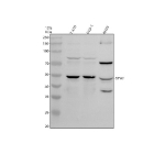 Western blot analysis of STYK1 using anti-STYK1 antibody. Electrophoresis was performed on a 10% SDS-PAGE gel at 80V (Stacking gel) / 120V (Resolving gel) for 2 hours. Lane 1: human T-47D whole cell lysates, Lane 2: human DLD-1 whole cell lysates, Lane 3: rat RH35 whole cell lysates. After electrophoresis, proteins were transferred to a nitrocellulose membrane at 150 mA for 50-90 minutes. Blocked the membrane with 5% non-fat milk/TBS for 1.5 hour at RT. The membrane was incubated with rabbit anti-STYK1 antibody at 0.5 ug/ml overnight at 4oC, then washed with TBS-0.1%Tween 3 times with 5 minutes each and probed with a goat anti-rabbit IgG-HRP secondary antibody at a dilution of 1:5000 for 1.5 hour at RT. The signal was developed using an ECL Plus Western Blotting Substrate. A specific band was detected for STYK1 at approximately 48 kDa. The expected molecular weight of STYK1 is ~48 kDa.