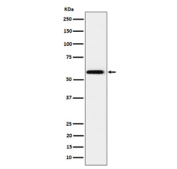 Western blot analysis of PPAR gamma expression in human HeLa cell lysate using PPAR gamma antibody. Predicted molecular weight: 54-57 kDa.