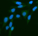 Immunofluorescent staining of PKN3 using anti-PKN3 antibody (green). PKN3 was detected in an immunocytochemical section of HELA cells. Enzyme antigen retrieval was performed using IHC enzyme antigen retrieval reagent for 15 mins. The cells were blocked with 10% goat serum. And then incubated with 5 ug/ml rabbit anti-PKN3 antibody overnight at 4oC. DyLight 488 Conjugated Goat Anti-Rabbit IgG was used as secondary antibody at 1:500 dilution and incubated for 30 minutes at 37oC. The section was counterstained with DAPI nuclear stain (blue). Visualize using a fluorescence microscope and filter sets appropriate for the label used.