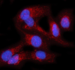 Immunofluorescent staining of PRAG1 using anti-PRAG1 antibody (red). PRAG1 was detected in an immunocytochemical section of human HELA cells. Enzyme antigen retrieval was performed using IHC enzyme antigen retrieval reagent for 15 mins. The cells were blocked with 10% goat serum. And then incubated with 5 ug/ml rabbit anti-PRAG1 antibody overnight at 4oC. Cy3 Conjugated Goat Anti-Rabbit IgG was used as secondary antibody at 1:500 dilution and incubated for 30 minutes at 37oC. The section was counterstained with DAPI nuclear stain (blue). Visualize using a fluorescence microscope and filter sets appropriate for the label used.