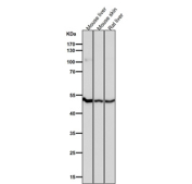 All lanes use the PSMC4 antibody at 1:3000 dilution for 1 hour at room temperature. Predicted molecular weight: 44-47 kDa (multiple isoforms).