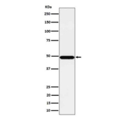 Western blot analysis of Tbp7/PSMC4 expression in human HeLa cell lysate using PSMC4 antibody. Predicted molecular weight: 44-47 kDa (multiple isoforms).