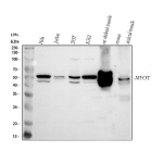 Western blot analysis of MYOT using anti-MYOT antibody. Lane 1: human Hela whole cell lysates, Lane 2: human Jurkat whole cell lysates, Lane 3: human 293T whole cell lysates, Lane 4: human K562 whole cell lysates, Lane 5: rat skeletal muscle tissue lysates, Lane 6: mouse skeletal muscle tissue lysates. After electrophoresis, proteins were transferred to a nitrocellulose membrane at 150 mA for 50-90 minutes. Blocked the membrane with 5% non-fat milk/TBS for 1.5 hour at RT. The membrane was incubated with rabbit anti-MYOT antibody at 0.5 ug/ml overnight at 4oC, then washed with TBS-0.1%Tween 3 times with 5 minutes each and probed with a goat anti-rabbit IgG-HRP secondary antibody at a dilution of 1:5000 for 1.5 hour at RT. The signal was developed using enhanced chemiluminescent. MYOT western blot across cell lines and muscle tissues shows the expected ~55 kDa band for full-length myotilin, with an additional ~45 kDa band that likely represents a truncated/short isoform or a proteolytic fragment enriched in muscle extracts.