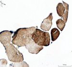 Immunohistochemical staining of MYOT using anti-MYOT antibody. MYOT was detected in a paraffin-embedded section of human skeletal muscle tissue. Heat mediated antigen retrieval was performed in EDTA buffer (pH 8.0, epitope retrieval solution). The tissue section was blocked with 10% goat serum. The tissue section was then incubated with 2 ug/ml rabbit anti-MYOT antibody overnight at 4oC. Peroxidase Conjugated Goat Anti-rabbit IgG was used as secondary antibody and incubated for 30 minutes at 37oC. The tissue section was developed using an HRP secondary and DAB substrate.