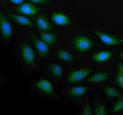 Immunofluorescent staining of PLAAT4 using anti-PLAAT4 antibody. PLAAT4 was detected in an immunocytochemical section of U2OS cells. Enzyme antigen retrieval was performed using IHC enzyme antigen retrieval reagent for 15 mins. The cells were blocked with 10% goat serum. And then incubated with 5 ug/ml rabbit anti-PLAAT4 antibody overnight at 4oC. DyLight 488 Conjugated Goat Anti-Rabbit IgG was used as secondary antibody at 1:500 dilution and incubated for 30 minutes at 37oC. The section was counterstained with DAPI nuclear stain (blue). Visualize using a fluorescence microscope and filter sets appropriate for the label used.