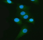 Immunofluorescent staining of Melanophilin/MLPH using anti-MLPH antibody (green). Melanophilin/MLPH was detected in an immunocytochemical section of cells. Enzyme antigen retrieval was performed using IHC enzyme antigen retrieval reagent for 15 mins. The cells were blocked with 10% goat serum. And then incubated with 5 ug/ml rabbit anti-MLPH antibody overnight at 4oC. DyLight 488 Conjugated Goat Anti-Rabbit IgG was used as secondary antibody at 1:500 dilution and incubated for 30 minutes at 37oC. The section was counterstained with DAPI nuclear stain (blue). Visualize using a fluorescence microscope and filter sets appropriate for the label used.