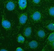 Immunofluorescent staining of ABCG5 using anti-ABCG5 antibody (green). ABCG5 was detected in an immunocytochemical section of CACO-2 cells. Enzyme antigen retrieval was performed using IHC enzyme antigen retrieval reagent for 15 mins. The cells were blocked with 10% goat serum. And then incubated with 5 ug/ml rabbit anti-ABCG5 antibody overnight at 4oC. DyLight 488 Conjugated Goat Anti-Rabbit IgG was used as secondary antibody at 1:500 dilution and incubated for 30 minutes at 37oC. The section was counterstained with DAPI nuclear stain (blue). Visualize using a fluorescence microscope and filter sets appropriate for the label used.