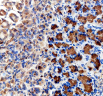 Immunohistochemical staining of ABCG5 using anti-ABCG5 antibody. ABCG5 was detected in a paraffin-embedded section of rat stomach tissue. Heat mediated antigen retrieval was performed in EDTA buffer (pH 8.0, epitope retrieval solution). The tissue section was blocked with 10% goat serum. The tissue section was then incubated with 2 ug/ml rabbit anti-ABCG5 antibody overnight at 4oC. Peroxidase Conjugated Goat Anti-rabbit IgG was used as secondary antibody and incubated for 30 minutes at 37oC. The tissue section was developed using an HRP secondary and DAB substrate.
