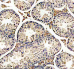 Immunohistochemical staining of GNAQ using anti-GNAQ antibody. GNAQ was detected in a paraffin-embedded section of mouse testis tissue. Heat mediated antigen retrieval was performed in EDTA buffer (pH 8.0, epitope retrieval solution). The tissue section was blocked with 10% goat serum. The tissue section was then incubated with 1:50 rabbit anti-GNAQ antibody overnight at 4oC. Peroxidase Conjugated Goat Anti-rabbit IgG was used as secondary antibody and incubated for 30 minutes at 37oC. The tissue section was developed using an HRP secondary and DAB substrate.