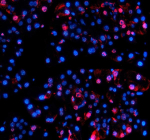Immunofluorescent staining of NUPR1 using anti-NUPR1 antibody (red). NUPR1 was detected in a paraffin-embedded section of mouse pancreas tissue. Heat mediated antigen retrieval was performed in EDTA buffer (pH 8.0, epitope retrieval solution). The tissue section was blocked with 10% goat serum. The tissue section was then incubated with 5 ug/ml rabbit anti-NUPR1 antibody overnight at 4oC. Cy3 Conjugated Goat Anti-Rabbit IgG was used as secondary antibody at 1:500 dilution and incubated for 30 minutes at 37oC. The section was counterstained with DAPI nuclear stain (blue). Visualize using a fluorescence microscope and filter sets appropriate for the label used.