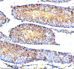Immunohistochemical staining of STAMBP using anti-STAMBP antibody. STAMBP was detected in a paraffin-embedded section of mouse testis tissue. Heat mediated antigen retrieval was performed in EDTA buffer (pH 8.0, epitope retrieval solution). The tissue section was blocked with 10% goat serum. The tissue section was then incubated with 2 ug/ml rabbit anti-STAMBP antibody overnight at 4oC. Peroxidase Conjugated Goat Anti-rabbit IgG was used as secondary antibody and incubated for 30 minutes at 37oC. The tissue section was developed using an HRP secondary and DAB substrate.