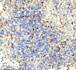 Immunohistochemical staining of STAMBP using anti-STAMBP antibody. STAMBP was detected in a paraffin-embedded section of human spleen tissue. Heat mediated antigen retrieval was performed in EDTA buffer (pH 8.0, epitope retrieval solution). The tissue section was blocked with 10% goat serum. The tissue section was then incubated with 2 ug/ml rabbit anti-STAMBP antibody overnight at 4oC. Peroxidase Conjugated Goat Anti-rabbit IgG was used as secondary antibody and incubated for 30 minutes at 37oC. The tissue section was developed using an HRP secondary and DAB substrate.
