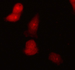 Immunofluorescent staining of STAMBP using anti-STAMBP antibody (red). STAMBP was detected in an immunocytochemical section of cells. Enzyme antigen retrieval was performed using IHC enzyme antigen retrieval reagent for 15 mins. The cells were blocked with 10% goat serum. And then incubated with 5 ug/ml rabbit anti-STAMBP antibody overnight at 4oC. Cy3-conjugated Anti-rabbit IgG Secondary antibody (red) was used as secondary antibody at 1:500 dilution and incubated for 30 minutes at 37oC. Visualize using a fluorescence microscope and filter sets appropriate for the label used.
