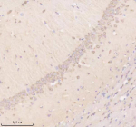 Immunohistochemical staining of TIMM9 using anti-TIMM9 antibody. TIMM9 was detected in a paraffin-embedded section of rat brain tissue. Heat mediated antigen retrieval was performed in EDTA buffer (pH 8.0, epitope retrieval solution). The tissue section was blocked with 10% goat serum. The tissue section was then incubated with 2 ug/ml rabbit anti-TIMM9 antibody overnight at 4oC. Peroxidase Conjugated Goat Anti-rabbit IgG was used as secondary antibody and incubated for 30 minutes at 37oC. The tissue section was developed using an HRP secondary and DAB substrate.