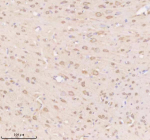 Immunohistochemical staining of TIMM9 using anti-TIMM9 antibody. TIMM9 was detected in a paraffin-embedded section of rat brain tissue. Heat mediated antigen retrieval was performed in EDTA buffer (pH 8.0, epitope retrieval solution). The tissue section was blocked with 10% goat serum. The tissue section was then incubated with 2 ug/ml rabbit anti-TIMM9 antibody overnight at 4oC. Peroxidase Conjugated Goat Anti-rabbit IgG was used as secondary antibody and incubated for 30 minutes at 37oC. The tissue section was developed using an HRP secondary and DAB substrate.