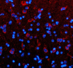 Immunofluorescent staining of TIMM9 using anti-TIMM9 antibody (red). TIMM9 was detected in a paraffin-embedded section of rat brain tissue. Heat mediated antigen retrieval was performed in EDTA buffer (pH 8.0, epitope retrieval solution). The tissue section was blocked with 10% goat serum. The tissue section was then incubated with 5 ug/ml rabbit anti-TIMM9 antibody overnight at 4oC. Cy3 Conjugated Goat Anti-Rabbit IgG was used as secondary antibody at 1:500 dilution and incubated for 30 minutes at 37oC. The section was counterstained with DAPI nuclear stain (blue). Visualize using a fluorescence microscope and filter sets appropriate for the label used.