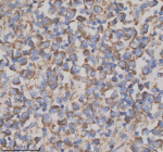 Immunohistochemical staining of GFRA2 using anti-GFRA2 antibody. GFRA2 was detected in a paraffin-embedded section of human testis cancer tissue. Heat mediated antigen retrieval was performed in EDTA buffer (pH 8.0, epitope retrieval solution). The tissue section was blocked with 10% goat serum. The tissue section was then incubated with 2 ug/ml rabbit anti-GFRA2 antibody overnight at 4oC. Peroxidase Conjugated Goat Anti-rabbit IgG was used as secondary antibody and incubated for 30 minutes at 37oC. The tissue section was developed using an HRP secondary and DAB substrate.