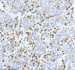 Immunohistochemical staining of PCYOX1 using anti-PCYOX1 antibody. PCYOX1 was detected in a paraffin-embedded section of human testicular seminoma tissue. Heat mediated antigen retrieval was performed in EDTA buffer (pH 8.0, epitope retrieval solution). The tissue section was blocked with 10% goat serum. The tissue section was then incubated with 2 ug/ml rabbit anti-PCYOX1 antibody overnight at 4oC. Peroxidase Conjugated Goat Anti-rabbit IgG was used as secondary antibody and incubated for 30 minutes at 37oC. The tissue section was developed using an HRP secondary and DAB substrate.