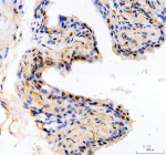 Immunohistochemical staining of SPOPL using anti-SPOPL antibody. SPOPL was detected in a paraffin-embedded section of mouse bladder tissue. Heat mediated antigen retrieval was performed in EDTA buffer (pH 8.0, epitope retrieval solution). The tissue section was blocked with 10% goat serum. The tissue section was then incubated with 2 ug/ml rabbit anti-SPOPL antibody overnight at 4oC. Peroxidase Conjugated Goat Anti-rabbit IgG was used as secondary antibody and incubated for 30 minutes at 37oC. The tissue section was developed using an HRP secondary and DAB substrate.