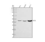 Western blot analysis of SPOPL using anti-SPOPL antibody. Electrophoresis was performed on a 10% SDS-PAGE gel at 80V (Stacking gel) / 120V (Resolving gel) for 2 hours. Lane 1: human Hela whole cell lysates, Lane 2: human HepG2 whole cell lysates, Lane 3: human MCF-7 whole cell lysates. After electrophoresis, proteins were transferred to a nitrocellulose membrane at 150 mA for 50-90 minutes. Blocked the membrane with 5% non-fat milk/TBS for 1.5 hour at RT. The membrane was incubated with rabbit anti-SPOPL antibody at 0.5 ug/ml overnight at 4oC, then washed with TBS-0.1%Tween 3 times with 5 minutes each and probed with a goat anti-rabbit IgG-HRP secondary antibody at a dilution of 1:5000 for 1.5 hour at RT. The signal was developed using an ECL Plus Western Blotting Substrate. A specific band was detected for SPOPL at approximately 45 kDa. The expected molecular weight of SPOPL is ~45 kDa.