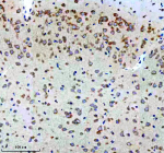 Immunohistochemical staining of CBR1 using anti-CBR1 antibody. CBR1 was detected in a paraffin-embedded section of mouse brain tissue. Heat mediated antigen retrieval was performed in EDTA buffer (pH 8.0, epitope retrieval solution). The tissue section was blocked with 10% goat serum. The tissue section was then incubated with 1:50 rabbit anti-CBR1 antibody overnight at 4oC. Peroxidase Conjugated Goat Anti-rabbit IgG was used as secondary antibody and incubated for 30 minutes at 37oC. The tissue section was developed using an HRP secondary and DAB substrate.