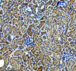 Immunohistochemical staining of CBR1 using anti-CBR1 antibody. CBR1 was detected in a paraffin-embedded section of mouse kidney tissue. Heat mediated antigen retrieval was performed in EDTA buffer (pH 8.0, epitope retrieval solution). The tissue section was blocked with 10% goat serum. The tissue section was then incubated with 1:50 rabbit anti-CBR1 antibody overnight at 4oC. Peroxidase Conjugated Goat Anti-rabbit IgG was used as secondary antibody and incubated for 30 minutes at 37oC. The tissue section was developed using an HRP secondary and DAB substrate.