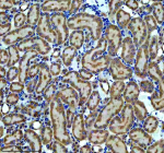 Immunohistochemical staining of CBR1 using anti-CBR1 antibody. CBR1 was detected in a paraffin-embedded section of rat kidney tissue. Heat mediated antigen retrieval was performed in EDTA buffer (pH 8.0, epitope retrieval solution). The tissue section was blocked with 10% goat serum. The tissue section was then incubated with 1:50 rabbit anti-CBR1 antibody overnight at 4oC. Peroxidase Conjugated Goat Anti-rabbit IgG was used as secondary antibody and incubated for 30 minutes at 37oC. The tissue section was developed using an HRP secondary and DAB substrate.