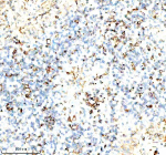 Immunohistochemical staining of SERPING1/C1 using anti-C1 Inhibitor (C1-INH) antibody. SERPING1/C1 was detected in a paraffin-embedded section of human spleen tissue. Heat mediated antigen retrieval was performed in EDTA buffer (pH 8.0, epitope retrieval solution). The tissue section was blocked with 10% goat serum. The tissue section was then incubated with 1:100 rabbit anti-C1 Inhibitor (C1-INH) antibody overnight at 4oC. Peroxidase Conjugated Goat Anti-rabbit IgG was used as secondary antibody and incubated for 30 minutes at 37oC. The tissue section was developed using an HRP secondary and DAB substrate.