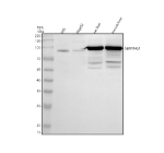Western blot analysis of SERPING1/C1 using anti-C1 Inhibitor (C1-INH) antibody. Electrophoresis was performed on a 10% SDS-PAGE gel at 80V (Stacking gel) / 120V (Resolving gel) for 2 hours. Lane 1: human HEL whole cell lysates, Lane 2: human HepG2 whole cell lysates Lane 3: rat liver tissue lysates, Lane 4: mouse liver tissue lysates. After electrophoresis, proteins were transferred to a nitrocellulose membrane at 150 mA for 50-90 minutes. Blocked the membrane with 5% non-fat milk/TBS for 1.5 hour at RT. The membrane was incubated with rabbit anti-C1 Inhibitor (C1-INH) antibody at 0.5 ug/ml overnight at 4oC, then washed with TBS-0.1%Tween 3 times with 5 minutes each and probed with a goat anti-rabbit IgG-HRP secondary antibody at a dilution of 1:5000 for 1.5 hour at RT. The signal was developed using an ECL Plus Western Blotting Substrate. A weak ~90 kDa band is detected in human lysates, while rat and mouse liver show a strong ~100 kDa band with additional weaker lower bands. The upward shift relative to the ~55 kDa polypeptide reflects heavy N-glycosylation of the mature protein, and the lower bands are consistent with cleaved or partially glycosylated forms reported for SERPING1 in tissue lysates.