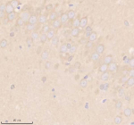 Immunohistochemical staining of SHD using anti-SHD antibody. SHD was detected in a paraffin-embedded section of rat brain tissue. Heat mediated antigen retrieval was performed in EDTA buffer (pH 8.0, epitope retrieval solution). The tissue section was blocked with 10% goat serum. The tissue section was then incubated with 2 ug/ml rabbit anti-SHD antibody overnight at 4oC. Peroxidase Conjugated Goat Anti-rabbit IgG was used as secondary antibody and incubated for 30 minutes at 37oC. The tissue section was developed using an HRP secondary and DAB substrate.