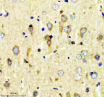 Immunohistochemical staining of SHD using anti-SHD antibody. SHD was detected in a paraffin-embedded section of rat brain tissue. Heat mediated antigen retrieval was performed in EDTA buffer (pH 8.0, epitope retrieval solution). The tissue section was blocked with 10% goat serum. The tissue section was then incubated with 2 ug/ml rabbit anti-SHD antibody overnight at 4oC. Peroxidase Conjugated Goat Anti-rabbit IgG was used as secondary antibody and incubated for 30 minutes at 37oC. The tissue section was developed using an HRP secondary and DAB substrate.