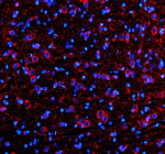 Immunofluorescent staining of SHD using anti-SHD antibody. SHD was detected in a paraffin-embedded section of rat brain tissue. Heat mediated antigen retrieval was performed in EDTA buffer (pH 8.0, epitope retrieval solution). The tissue section was blocked with 10% goat serum. The tissue section was then incubated with 5 ug/ml rabbit anti-SHD antibody overnight at 4oC. Cy3 Conjugated Goat Anti-Rabbit IgG was used as secondary antibody at 1:500 dilution and incubated for 30 minutes at 37oC. The section was counterstained with DAPI nuclear stain (blue). Visualize using a fluorescence microscope and filter sets appropriate for the label used.
