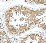 Immunohistochemical staining of ABCE1 using anti-ABCE1 antibody. ABCE1 was detected in a paraffin-embedded section of human testis tissue. Heat mediated antigen retrieval was performed in EDTA buffer (pH 8.0, epitope retrieval solution). The tissue section was blocked with 10% goat serum. The tissue section was then incubated with 2 ug/ml rabbit anti-ABCE1 antibody overnight at 4oC. Peroxidase Conjugated Goat Anti-rabbit IgG was used as secondary antibody and incubated for 30 minutes at 37oC. The tissue section was developed using an HRP secondary and DAB substrate.