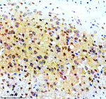 Immunohistochemical staining of STX4 using anti-STX4 antibody. STX4 was detected in a paraffin-embedded section of rat brain tissue. Heat mediated antigen retrieval was performed in EDTA buffer (pH 8.0, epitope retrieval solution). The tissue section was blocked with 10% goat serum. The tissue section was then incubated with 2 ug/ml rabbit anti-STX4 antibody overnight at 4oC. Peroxidase Conjugated Goat Anti-rabbit IgG was used as secondary antibody and incubated for 30 minutes at 37oC. The tissue section was developed using an HRP secondary and DAB substrate.